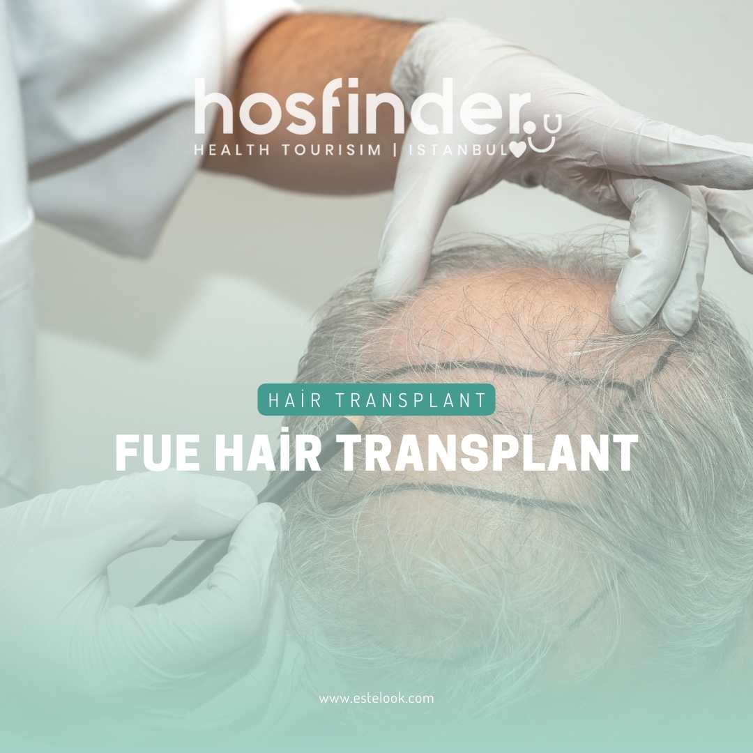 Fue Hair Transplant